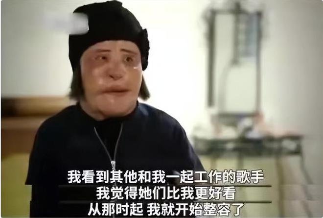 整容上瘾自行注射大豆油最终把脸整成电风扇AG真人百家家乐app颜值不输张曼玉却(图7)