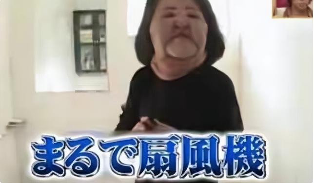 整容上瘾自行注射大豆油最终把脸整成电风扇AG真人百家家乐app颜值不输张曼玉却(图11)
