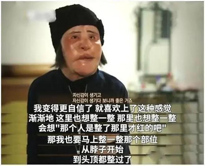 整容上瘾自行注射大豆油最终把脸整成电风扇AG真人百家家乐app颜值不输张曼玉却(图12)